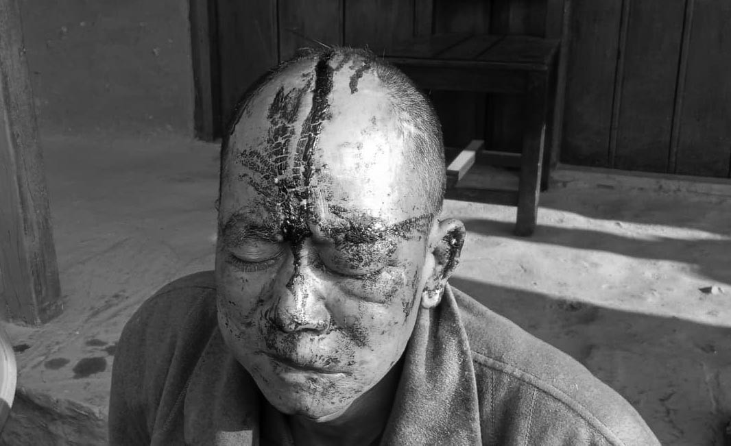 बिहेबाट फर्किदै गर्दा कुटपिट, एकजना सख्त घाईते