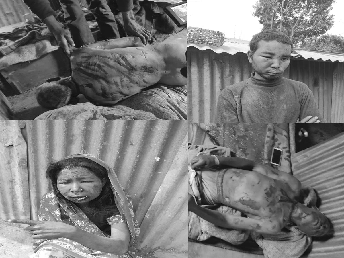 झारफुकको नाममा डामिएर हत्या गरिएका र घाइते बनाइएका पीडितहरु