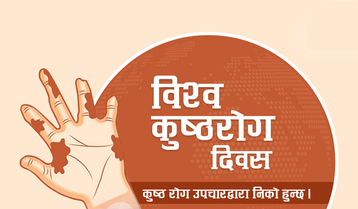 आज ७१औँ विश्व कुष्ठरोग दिवसः मधेसमा अधिक कुष्ठरोगी 