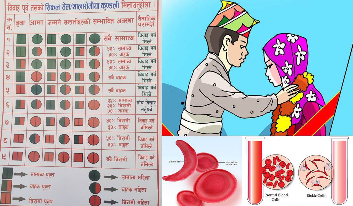 ‘सिकलसेल कुण्डली मिलाएरमात्र विवाह गर्नूस्’